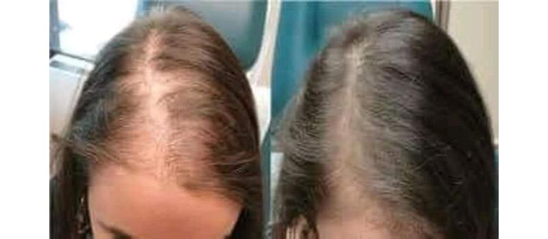 hair damage control